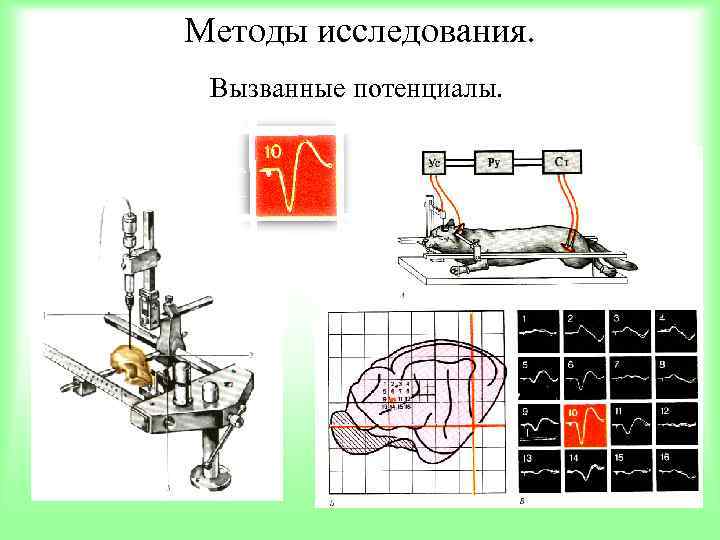 Методы исследования. Вызванные потенциалы. 
