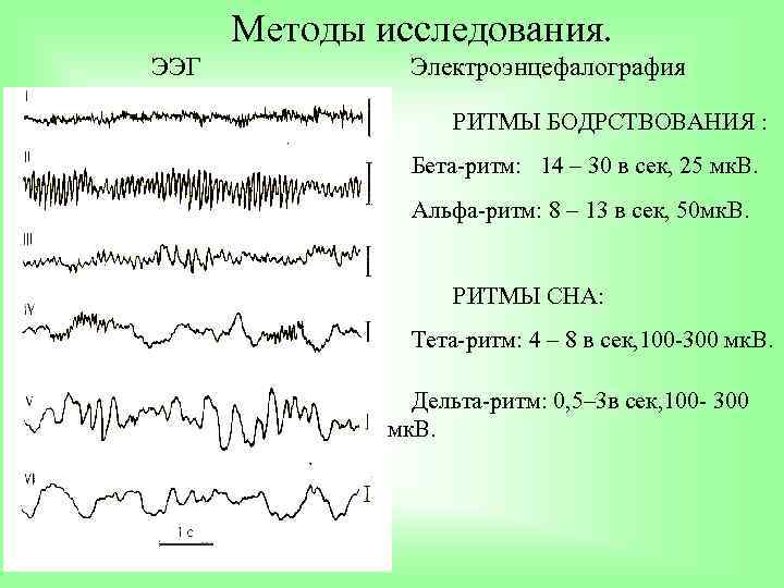 Методы исследования. ЭЭГ Электроэнцефалография РИТМЫ БОДРСТВОВАНИЯ : Бета-ритм: 14 – 30 в сек, 25