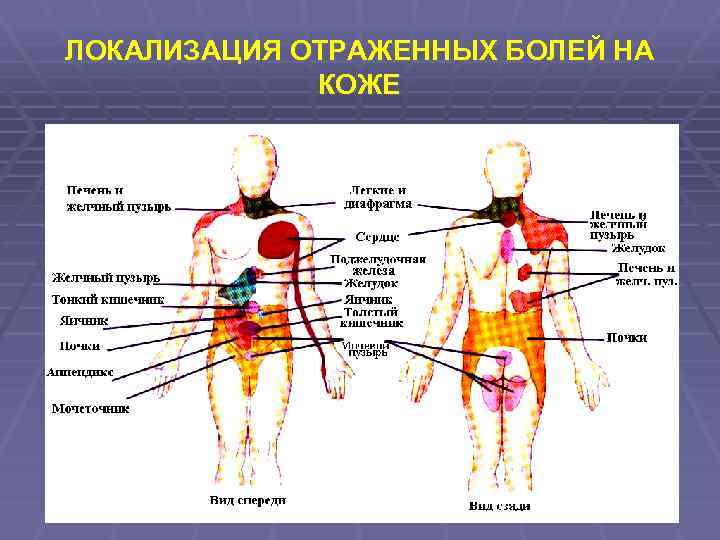 ЛОКАЛИЗАЦИЯ ОТРАЖЕННЫХ БОЛЕЙ НА КОЖЕ 