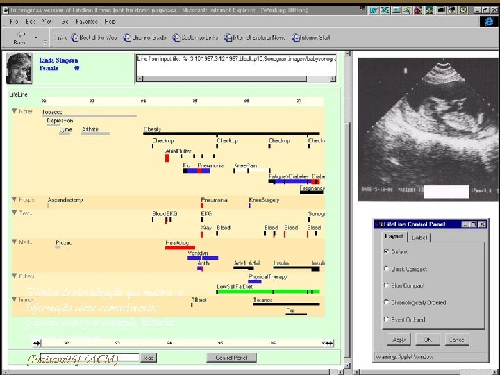 Técnica de visualização que mostra a informação sobre acontecimentos pessoais como por exemplo, histórias
