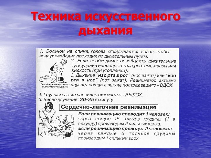 Техника искусственного дыхания 