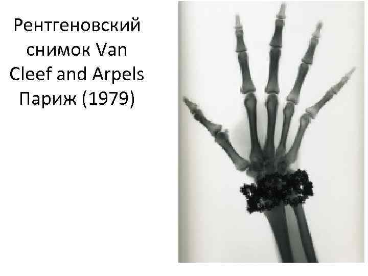 Рентгеновский снимок Van Cleef and Arpels Париж (1979) 
