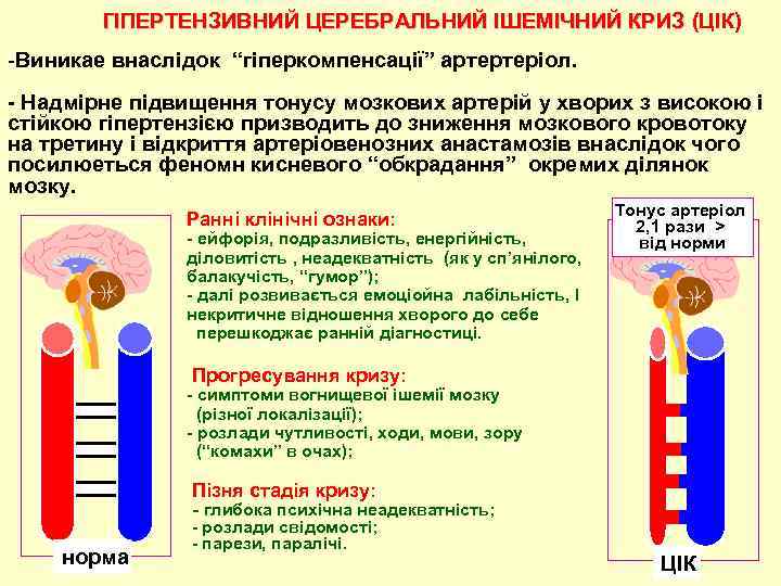 ГІПЕРТЕНЗИВНИЙ ЦЕРЕБРАЛЬНИЙ ІШЕМІЧНИЙ КРИЗ (ЦІК) -Виникае внаслідок “гiперкомпенсацiї” артертеріол. - Надмiрне пiдвищення тонусу мозкових