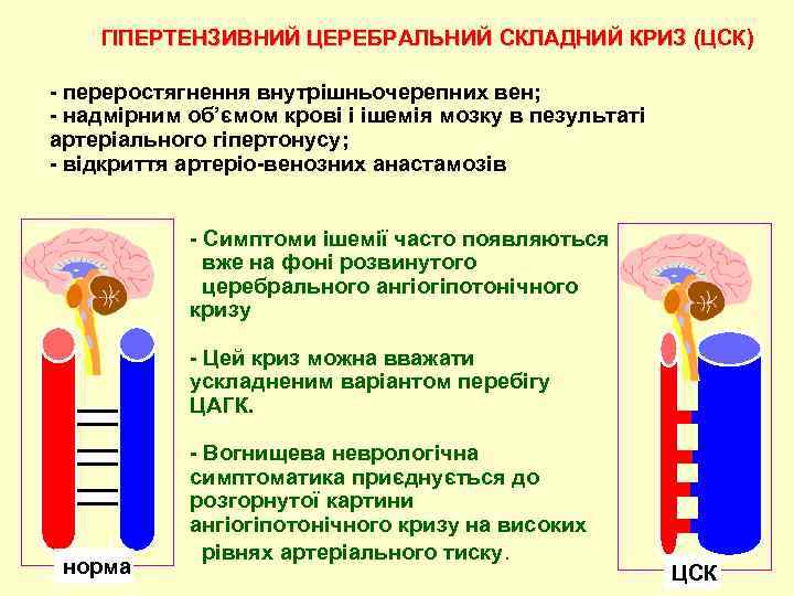 ГІПЕРТЕНЗИВНИЙ ЦЕРЕБРАЛЬНИЙ СКЛАДНИЙ КРИЗ (ЦСК) - переростягнення внутрiшньочерепних вен; - надмiрним об’ємом кровi i