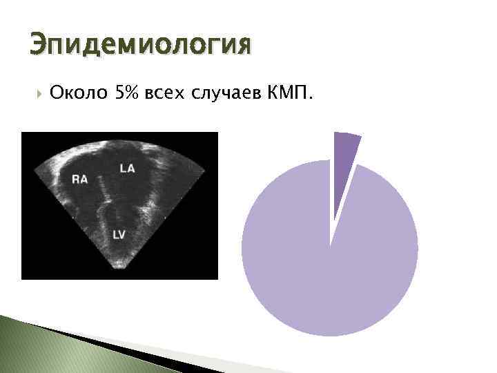 Эпидемиология Около 5% всех случаев КМП. 