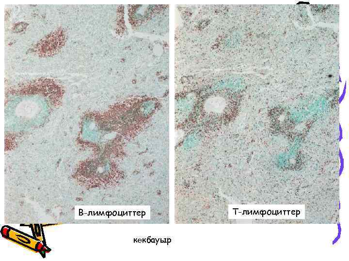 В-лимфоциттер көкбауыр Т-лимфоциттер 