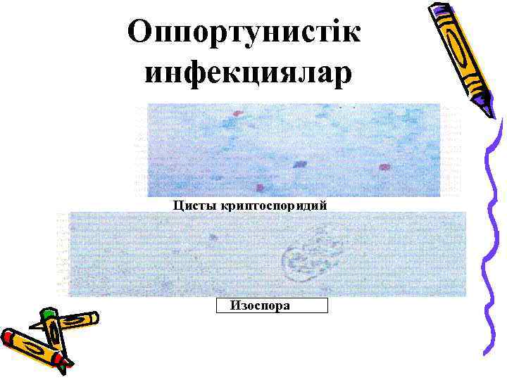 Оппортунистік инфекциялар Цисты криптоспоридий Изоспора 