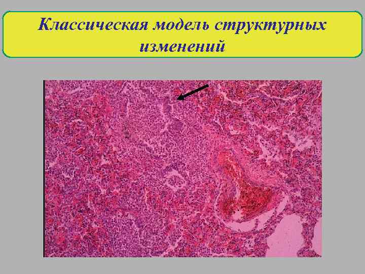 Классическая модель структурных изменений 