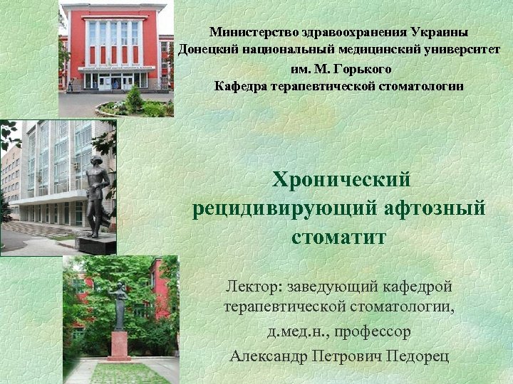 Министерство здравоохранения Украины Донецкий национальный медицинский университет им. М. Горького Кафедра терапевтической стоматологии Хронический