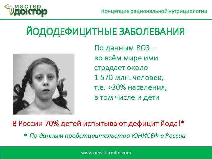 ЙОДОДЕФИЦИТНЫЕ ЗАБОЛЕВАНИЯ По данным ВОЗ – во всём мире ими страдает около 1 570