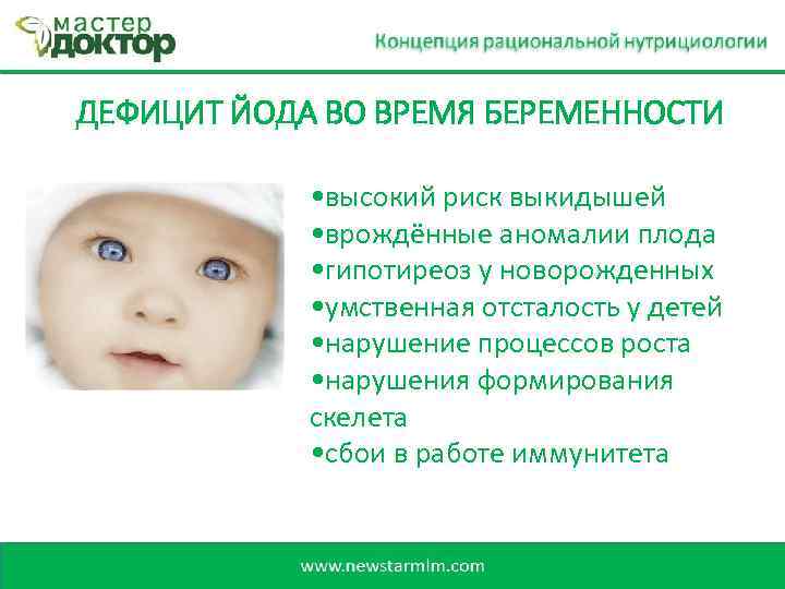 ДЕФИЦИТ ЙОДА ВО ВРЕМЯ БЕРЕМЕННОСТИ • высокий риск выкидышей • врождённые аномалии плода •