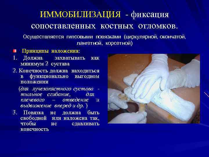 ИММОБИЛИЗАЦИЯ - фиксация сопоставленных костных отломков. Осуществляется гипсовыми повязками (циркулярной, окончатой, лангетной, корсетной) Принципы