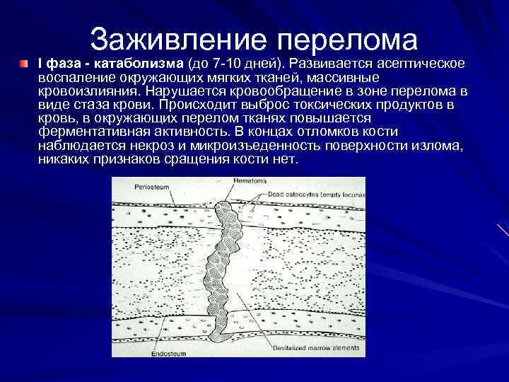 Заживление перелома I фаза - катаболизма (до 7 -10 дней). Развивается асептическое воспаление окружающих