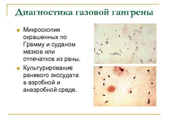 Диагностика газовой гангрены n n Микроскопия окрашенных по Грамму и суданом мазков или отпечатков