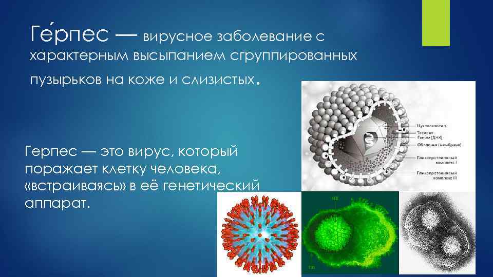 Презентация вирус простого герпеса