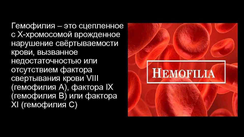 Гемофилия – это сцепленное с Х-хромосомой врожденное нарушение свёртываемости крови, вызванное недостаточностью или отсутствием