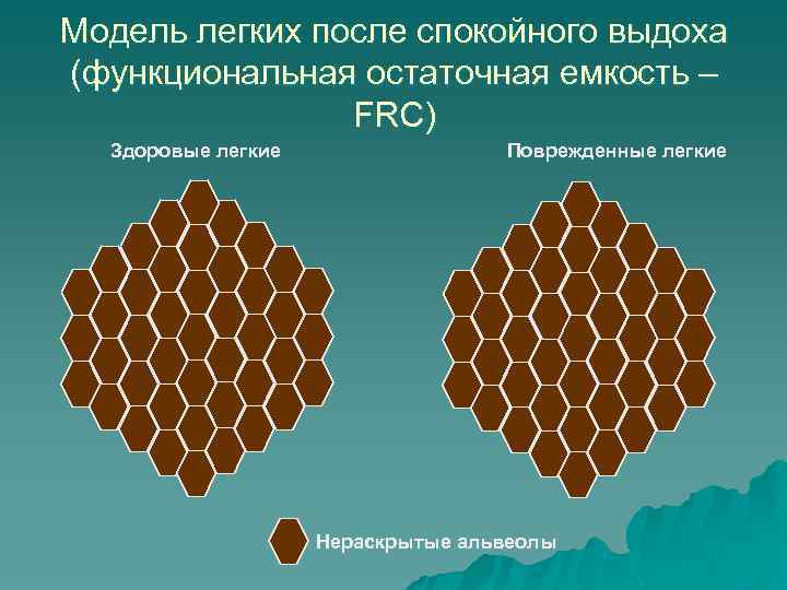 Модель легких после спокойного выдоха (функциональная остаточная емкость – FRC) Здоровые легкие Поврежденные легкие