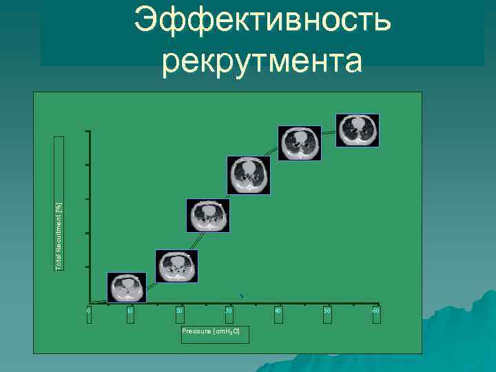 Total Recuitment [%] Эффективность рекрутмента 0 10 20 30 Pressure [cm. H 2 O]