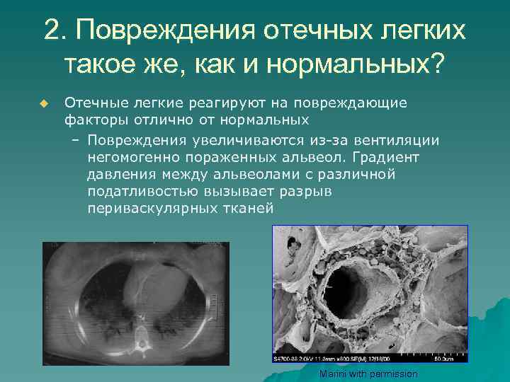 2. Повреждения отечных легких такое же, как и нормальных? u Отечные легкие реагируют на