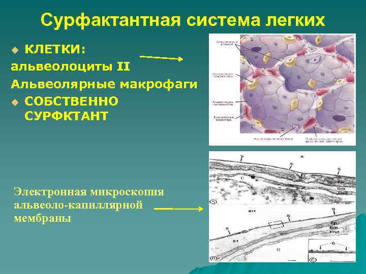 Сурфактантная система легких КЛЕТКИ: альвеолоциты II Альвеолярные макрофаги u СОБСТВЕННО СУРФКТАНТ u Электронная микроскопия