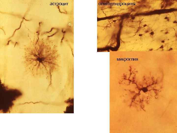 астроцит олигодендроциты микроглия 