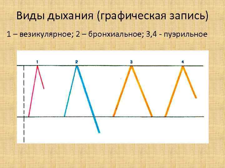 Виды дыхания (графическая запись) 1 – везикулярное; 2 – бронхиальное; 3, 4 - пуэрильное