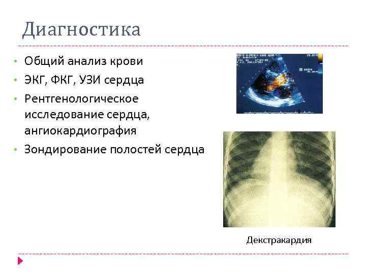 Диагностика • • Общий анализ крови ЭКГ, ФКГ, УЗИ сердца Рентгенологическое исследование сердца, ангиокардиография