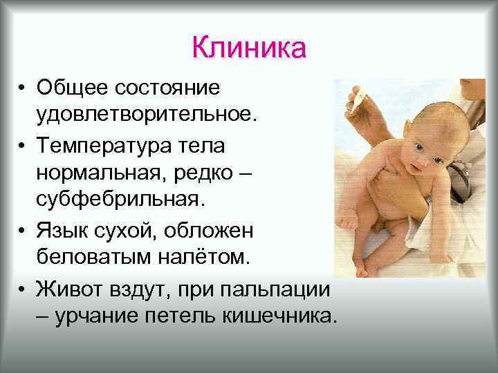 Клиника • Общее состояние удовлетворительное. • Температура тела нормальная, редко – субфебрильная. • Язык