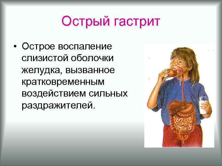 Острый гастрит • Острое воспаление слизистой оболочки желудка, вызванное кратковременным воздействием сильных раздражителей. 