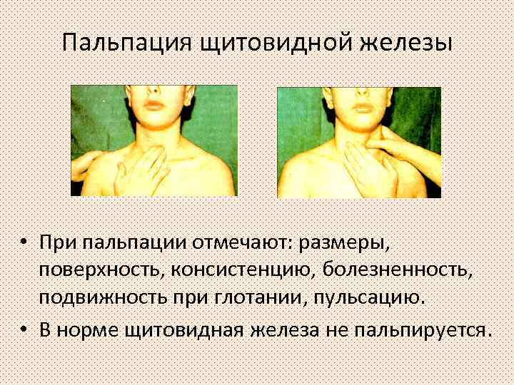 Пальпация щитовидной железы • При пальпации отмечают: размеры, поверхность, консистенцию, болезненность, подвижность при глотании,