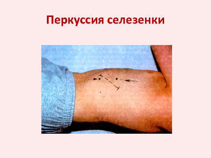 Перкуссия селезенки 