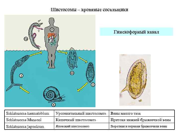 Шистосомы – кровяные сосальщики Гинекофорный канал Schistosoma haematobium Урогенитальный шистосомоз Вены малого таза Schistosoma