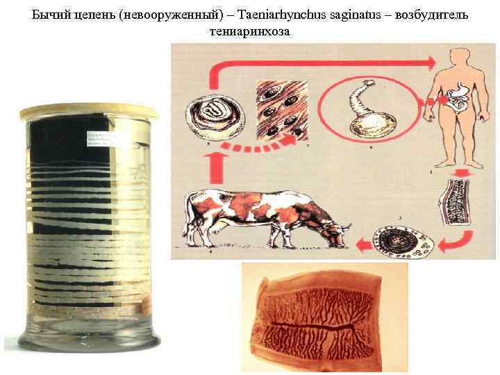 Бычий цепень (невооруженный) – Taeniarhynchus saginatus – возбудитель тениаринхоза 