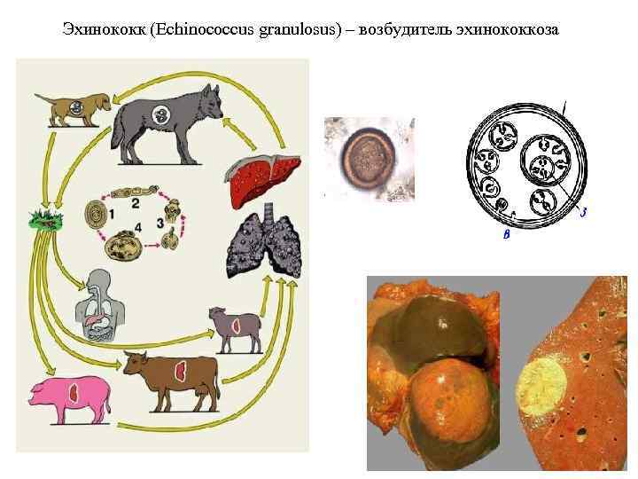 Эхинококк (Echinococcus granulosus) – возбудитель эхинококкоза 