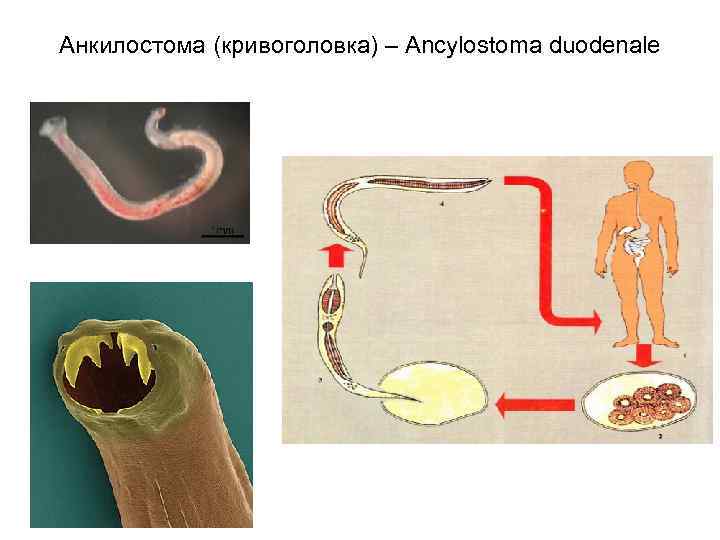 Анкилостома (кривоголовка) – Ancylostoma duodenale 