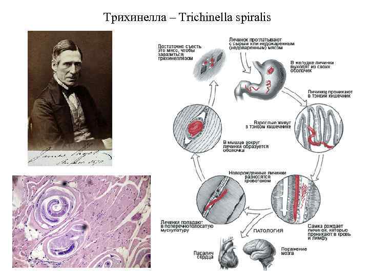 Трихинелла – Trichinella spiralis 