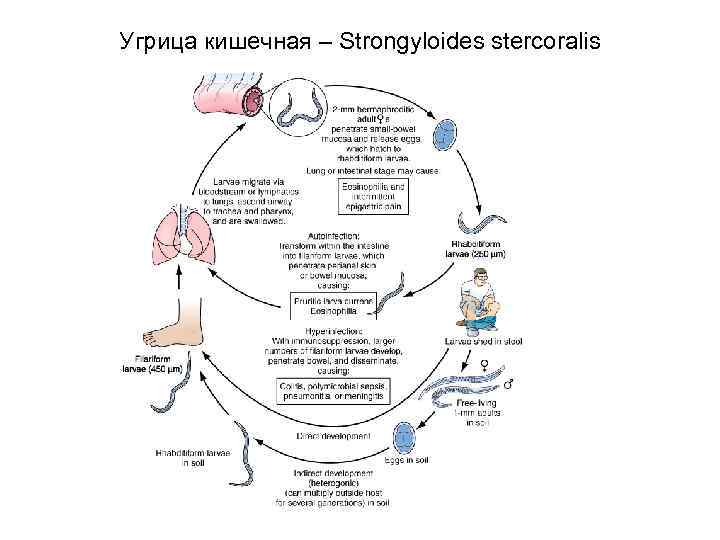 Угрица кишечная – Strongyloides stercoralis 