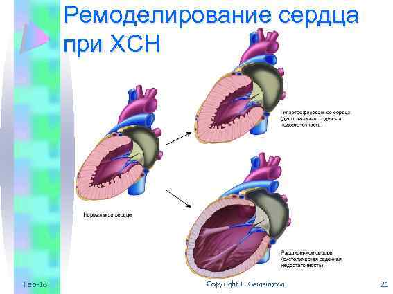 Ремоделирование сердца при ХСН Feb-18 Copyright L. Gerasimova 21 