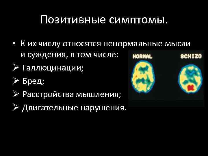 Позитивные симптомы. • К их числу относятся ненормальные мысли и суждения, в том числе: