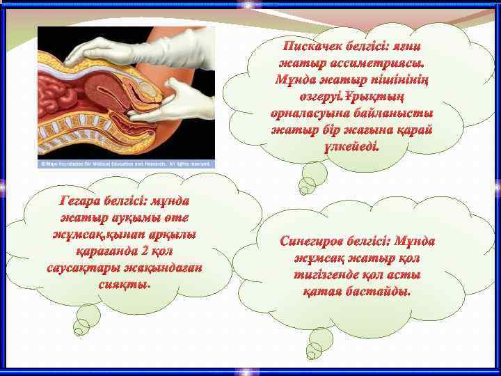 Пискачек белгісі: яғни жатыр ассиметриясы. Мұнда жатыр пішінінің өзгеруі. Ұрықтың орналасуына байланысты жатыр бір