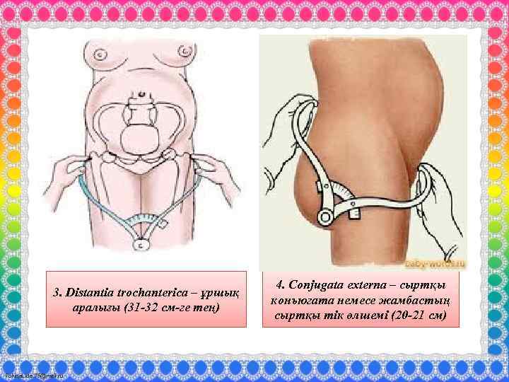 3. Distantia trochanterica – ұршық аралығы (31 -32 см-ге тең) Fokina. Lida. 75@mail. ru