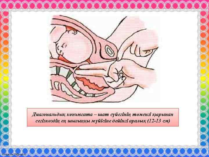 Диагональдық конъюгата – шат сүйегінің төменгі қырынан сегізкөздің ең шығыңқы мүйісіне дейінгі аралық (12