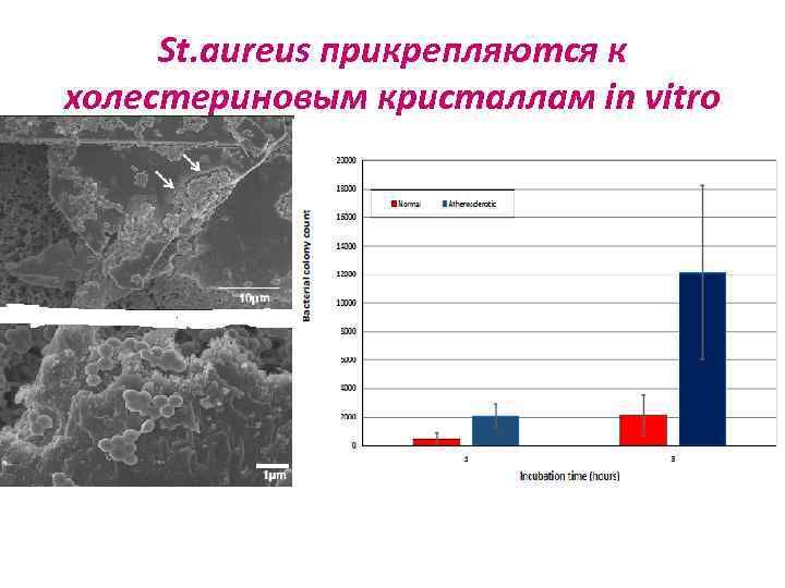 St. aureus прикрепляются к холестериновым кристаллам in vitro 