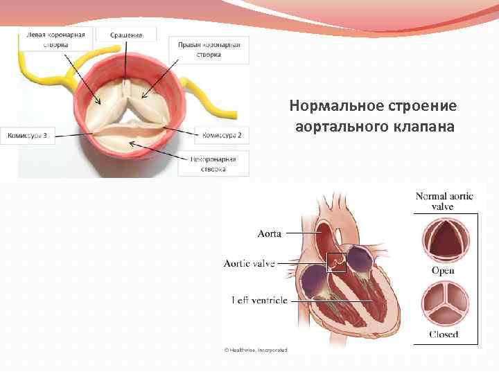 Нормальное строение аортального клапана 