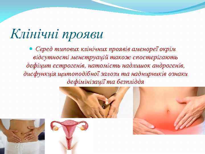 Клінічні прояви Серед типових клінічних проявів аменореї окрім відсутності менструацій також спостерігають дефіцит естрогенів,