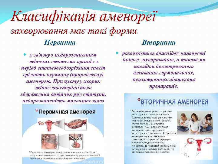 Класифікація аменореї захворювання має такі форми Первинна у зв'язку з недорозвиненням жіночих статевих органів