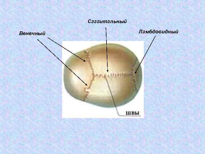 Саггитальный Венечный Ламбдовидный 