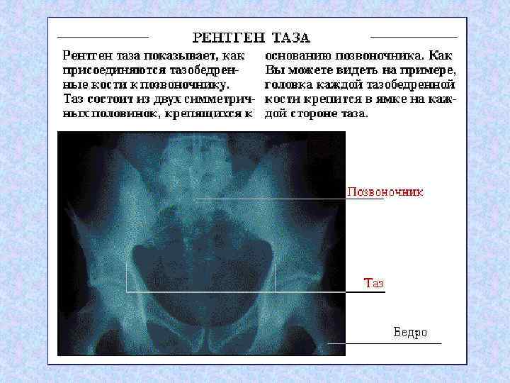 Сколько можно делать рентген. Кости таза рентген описание.