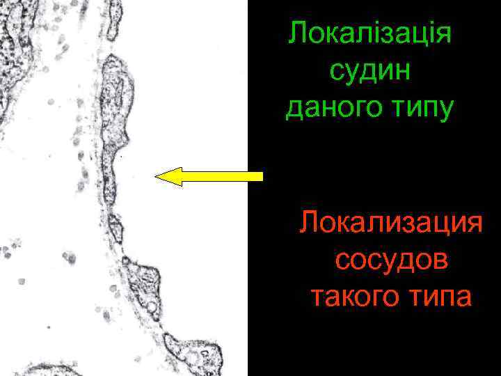 Локалізація судин даного типу Локализация сосудов такого типа 