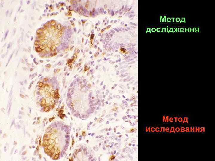 Метод дослідження Метод исследования 